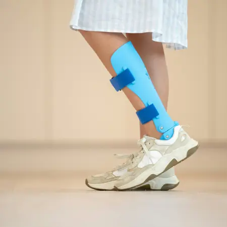 Hielspoor en fasciitis plantaris
